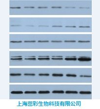 WB(核蛋白、线粒体蛋白、膜蛋白).jpg